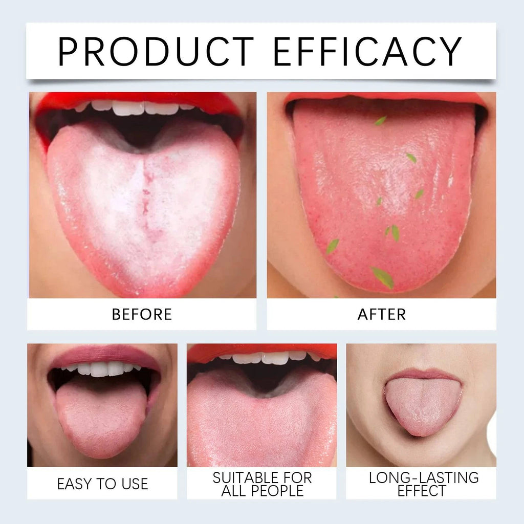 Nehwei enterprise tongue cleaning gel set with applicator for removing coating, inhibiting bacteria, and freshening breath.